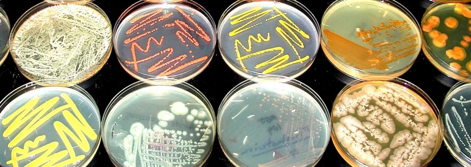 Аллерген сибиреязвенный антраксин. Кох питательные среды. Сибиреязвенная вакцина состав. Вакцина сибиреязвенная живая сухая. Основные питательные среды микробиология.