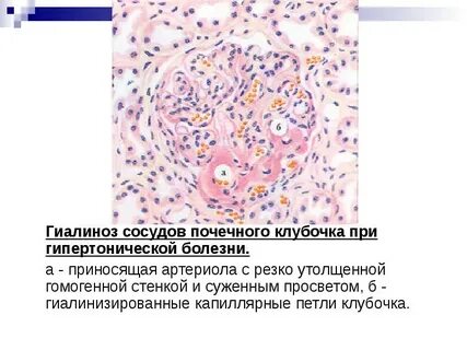 Артериолы почек