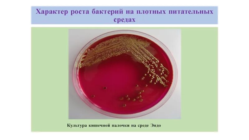 Рост колоний e.coli на среде Эндо. Рост эшерихий на среде Эндо. Рост кишечной палочки на среде Эндо. E coli на среде Эндо.