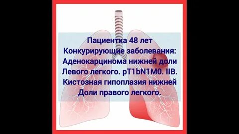 Как проходит па