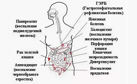 Болит живот ниже пупка при нажатии