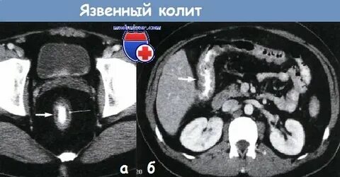 Яка причина