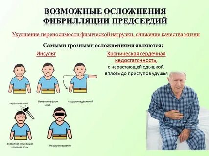 Осложнения фибрилляции