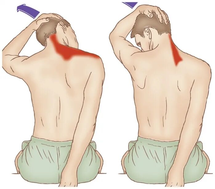 Болит правая лопатка и отдает в руку. Упражнения на растяжение мышц шеи. Упражнения для растяжения мышц спины и шеи. Растяжка мышц шейного отдела. Упражнения для растяжки мышц спины и шеи.