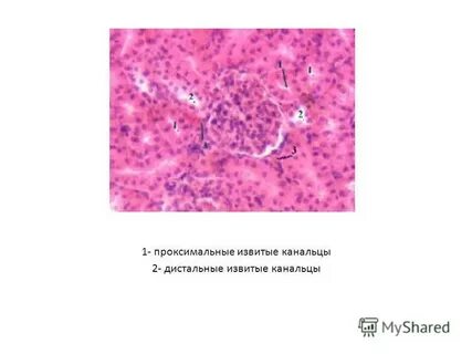Дистальный каналец почки