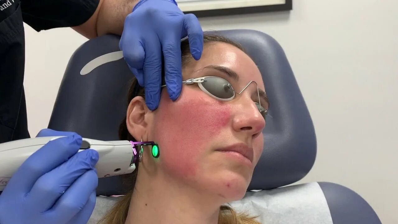 Омоложение сосудов