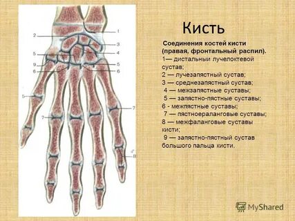 Суставы кисти ладонная поверхность