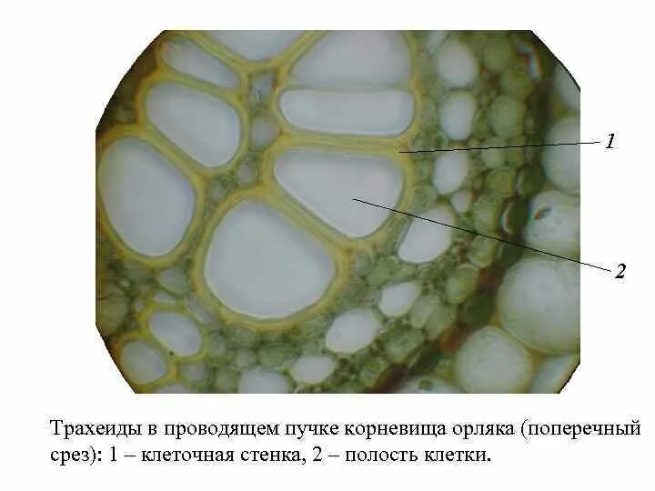 В клетках стебля лопуха. Поперечный срез корневища орляка ткани. Поперечный срез папоротника орляка. Поперечный срез орляка. Поперечный корневище орляка.