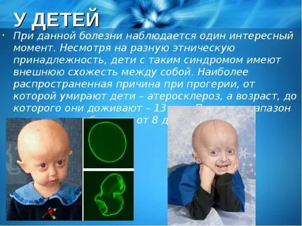 Болезнь без детей