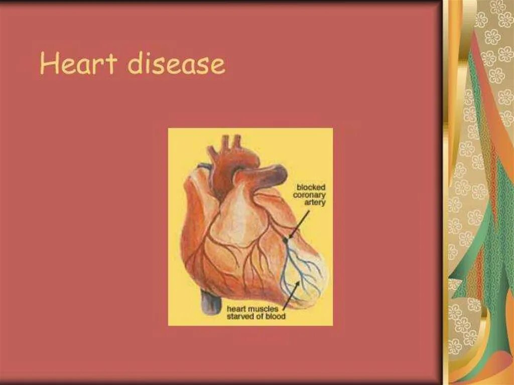 Heart disease causes. Heart disease causes. Сердце инфографика. Congenital heart disease classification. Ишемическая болезнь сердца.