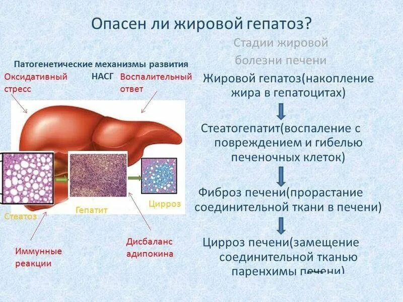 Жировая печень что кушать. Жировой гепатоз развивается при. Жировой гепатоз 2 степени. Жировое Перерождение печени.