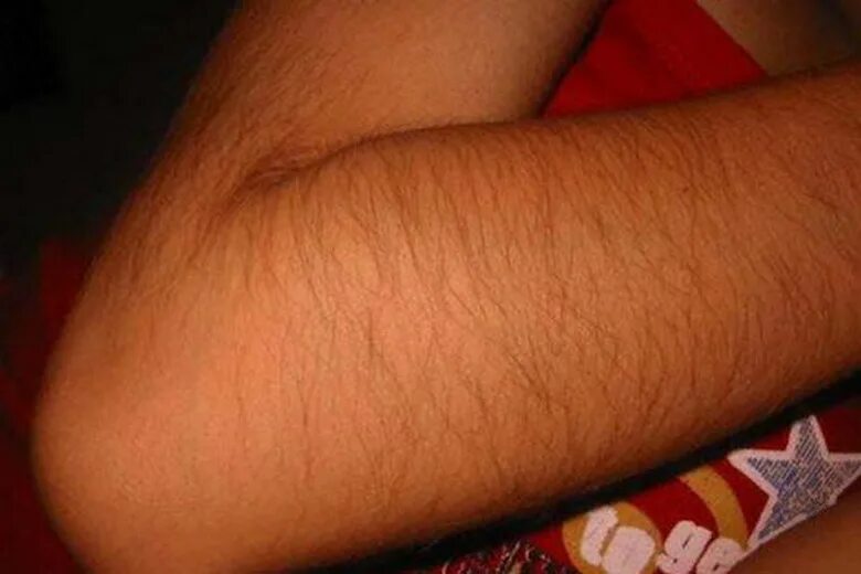 волосы на руках у девочки. волосы на руках у девушки нормально. волосы на руках у девушки. волосы на руках у девушки нормально. волосы на руках у девушки нормально.