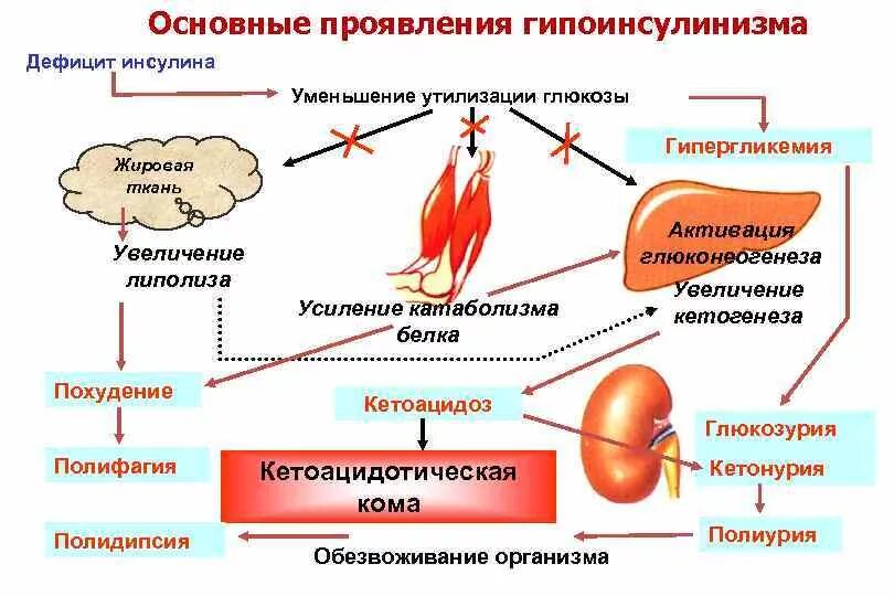 Заболевания обмена углеводов. Нарушение углеводного обмена заболевание. Нарушение обмена углеводов схема. Нарушение углеводного обмена схема. Типовые нарушения углеводного обмена патофизиология.