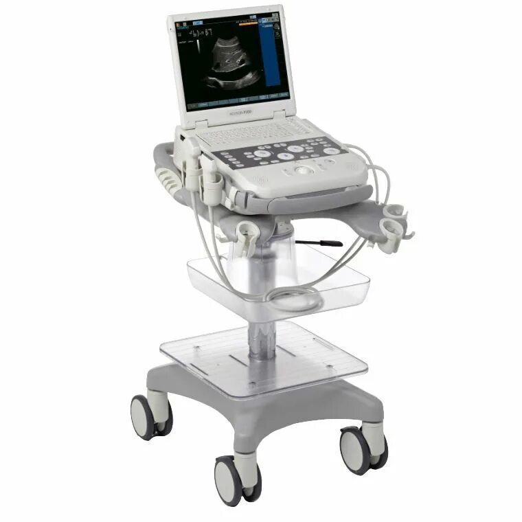 Экран аппарата узи. Узи siemens acuson x300. sonon 300 узи.