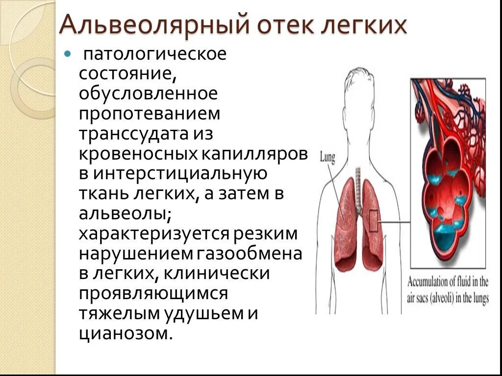 Легкие заполнены жидкостью. Альвеолярный отек легких. Альвеолярный отёк лёгких. Патологическое состояние легких.