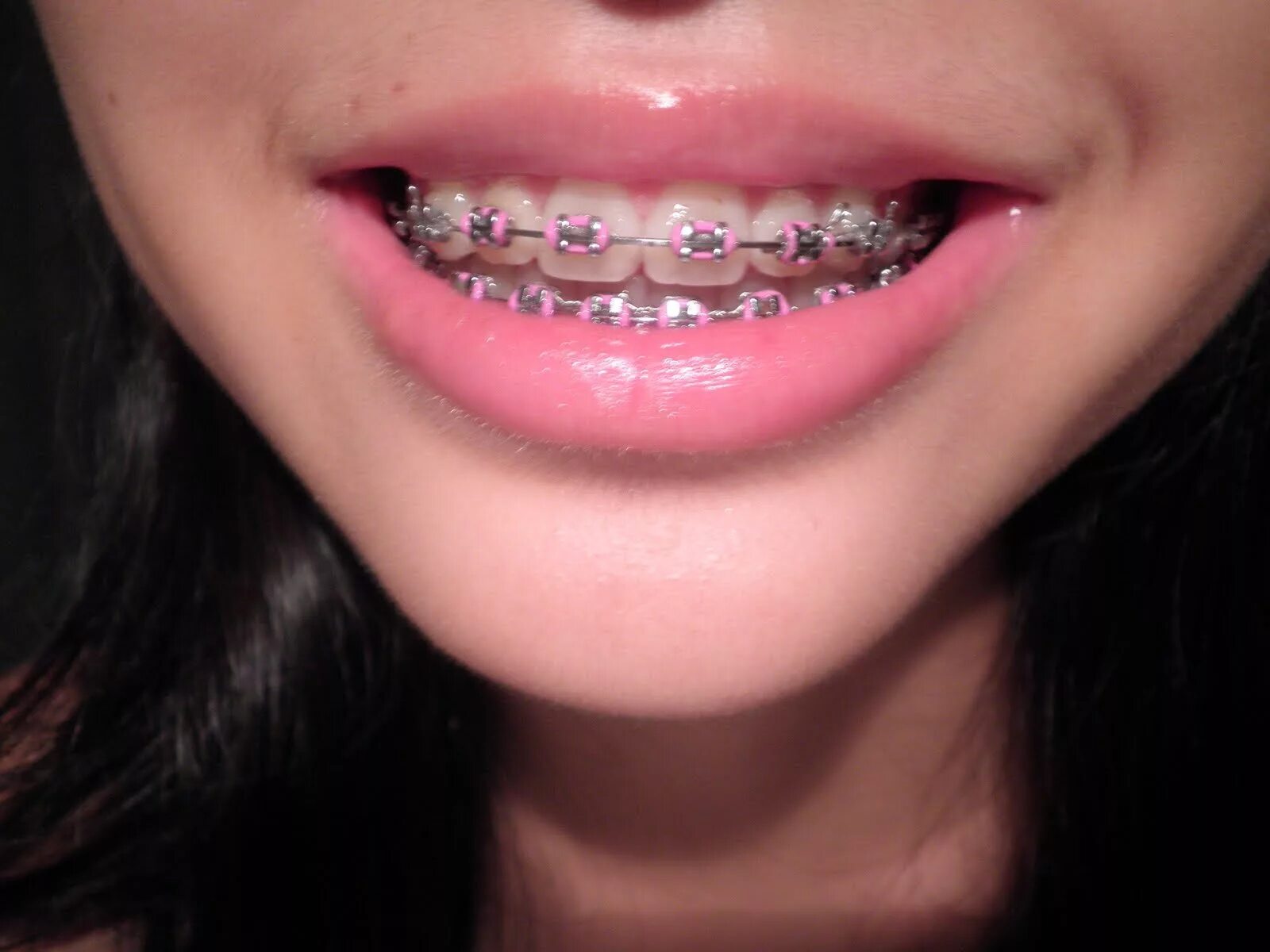 Matching brackets. Matching brackets