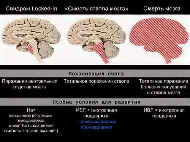 Сколько может прожить мозг. Смерть мозга. Гибель головного мозга. Клиническая смерть мозга.