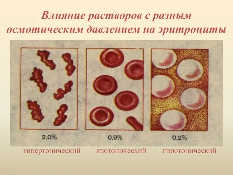 Эритроциты в растворе хлорида натрия. Эритроцит в гипотоническом и гипертоническом растворе. Гипотонический изотонический гипертонический раствор эритроциты. Эритроциты в изотоническом растворе. Эритроциты в гипотоническом растворе.