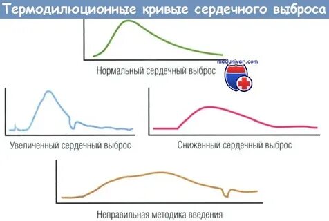 Частота сердечного выброса