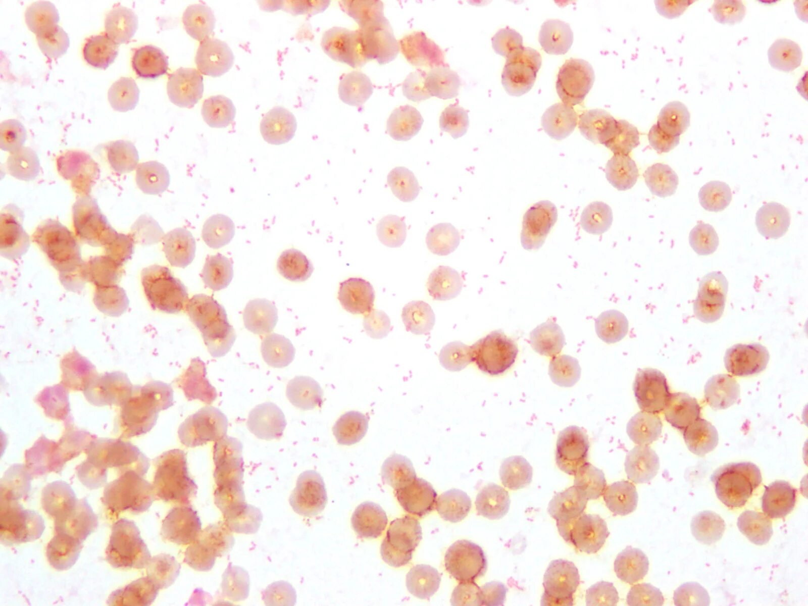Brucella spp. Бруцелла melitensis. brucella abortus микробиология. brucella abortus микроскопия. бруцеллы микроскопия.