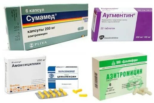 Какие лекарства принимать при инфекции. Антибиотики приинфекциистрептококовой. антибиотики стрептококковая инфекция. антибиотик при стрептококковой. таблетки от стрептококка.
