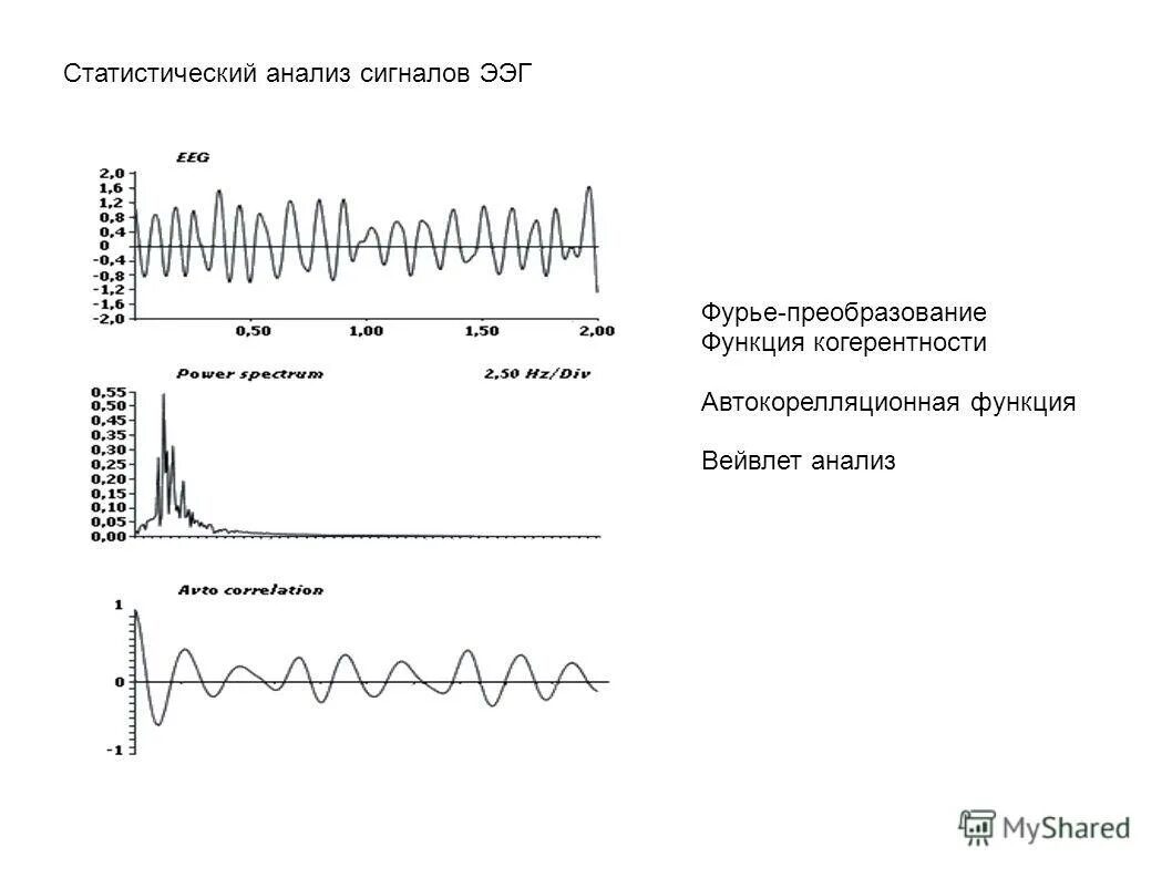 Ээг сигнал. Анализ электроэнцефалограммы. Вейвлет анализ ЭЭГ. Когерентность ЭЭГ.