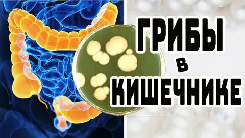 Грибок в организме как избавиться