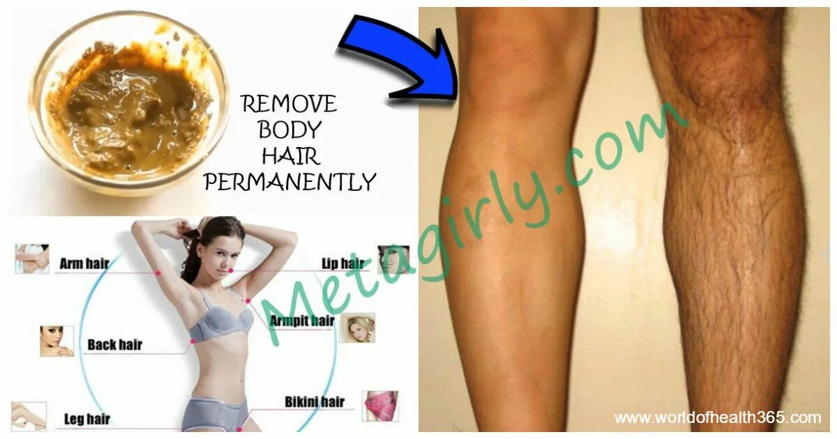 Delete body. Delete body. Delete body. Delete body. Застарелые пятна от зеленого чая.