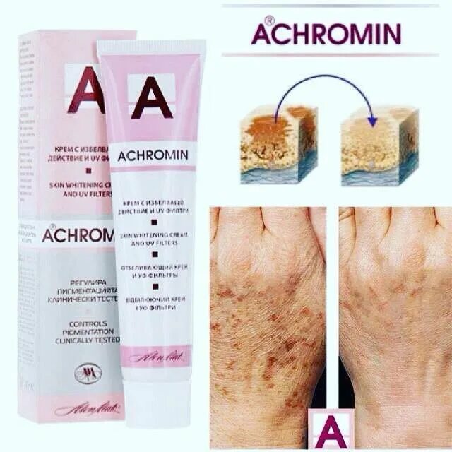 Отбеливание кожи от пигментных пятен. Ахромин макс от пигментных пятен. От пигментных пятен на лице. Отбеливание кожи от пигментных пятен. Ахромин от пигментных пятен.