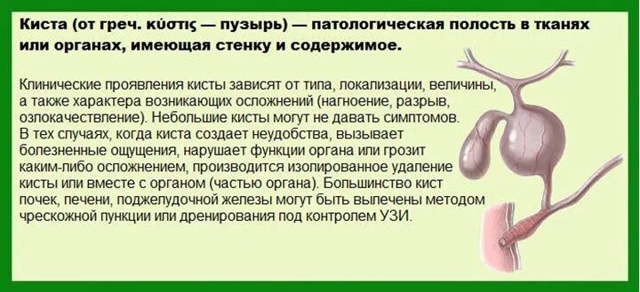 Субэпендимальная киста нейросонография. Бранхиогенная киста на узи. Арахноидальная киста головного мозга мрт. Постгеморрагическая киста головного мозга. Хронический гепатит узи заключение.