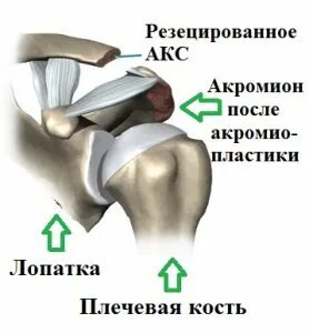Акс плечевого сустава