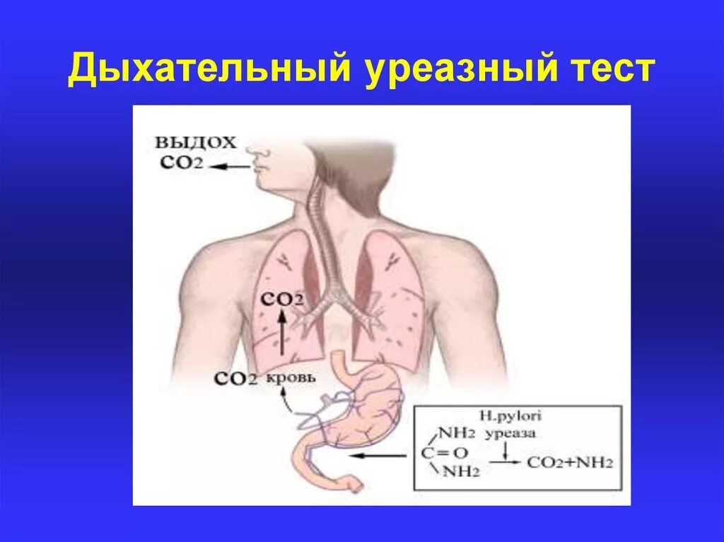 Нужен дыхательный тест. 13с-уреазный дыхательный. Урезальный дыхательный тест. Дательный уреазный тест. 13с-уреазный дыхательный тест.