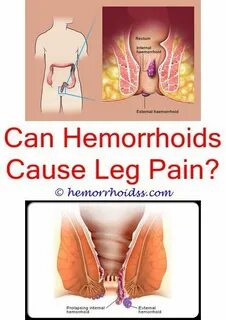 Ашық кисканың фотосы