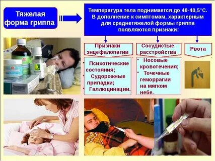 Для гриппа характерна температура
