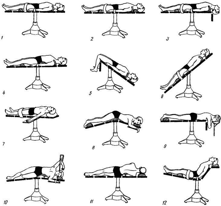 Положение больного на столе. Укладывание пациента на операционный стол. Укладка больного на операционном столе. Положение пациента на операционном столе. Позиции на операционном столе.
