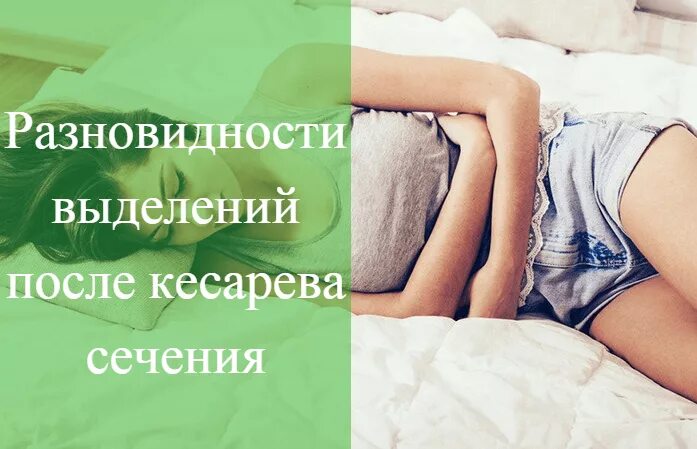 Выделения после кесарева сечения. Выделения после кесарева норма. Выделения лохий после кесарева сечения. Выделения после кесарева сечения норма.