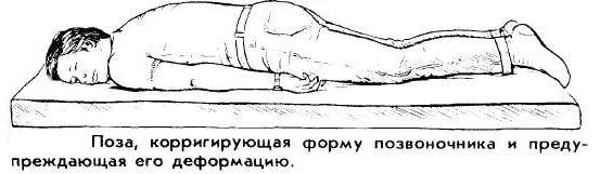 Упражнения лфк при болезни бехтерева. Упражнения лфк при болезни бехтерева