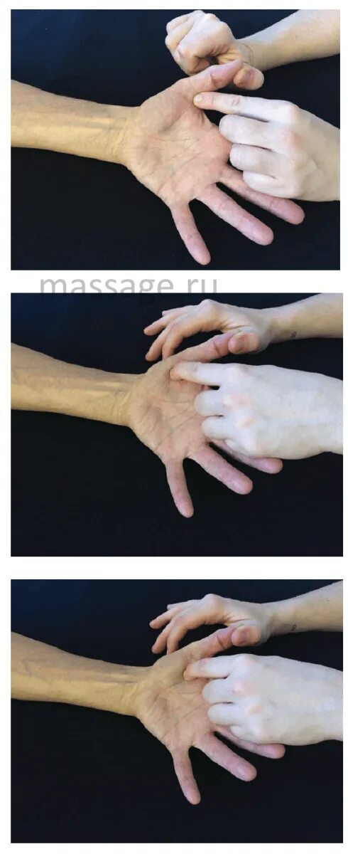 Повреждение сухожилий разгибателей пальцев кисти. Лучезапястный сустав кисти. Как разработать палец после разрыва. Массаж при растяжении кисти. Лфк сгибателя пальца кисти.