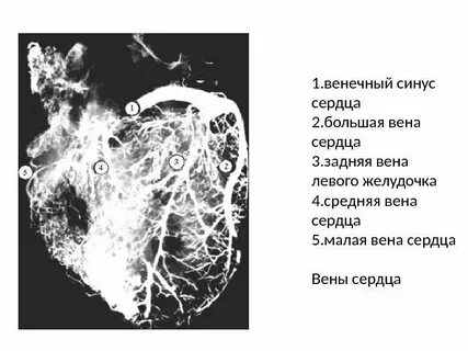 Сердце атланта ветки