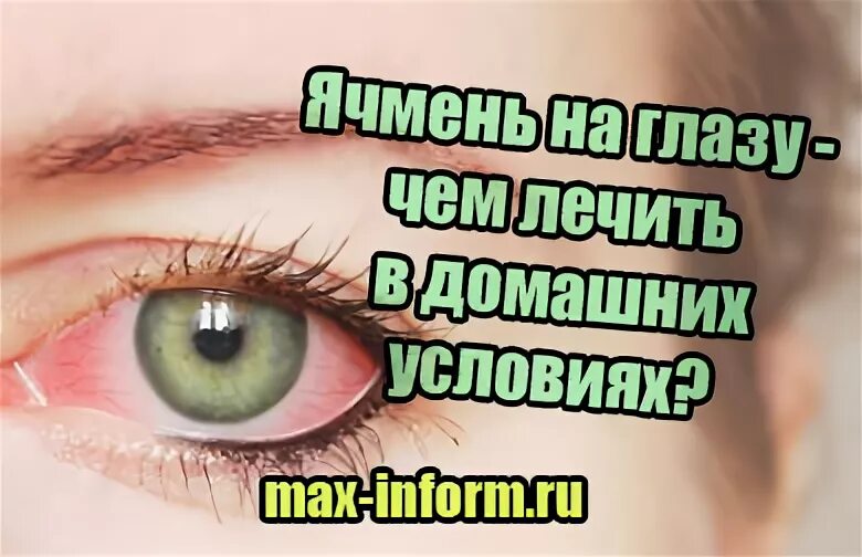 Как заговорить ячмень
