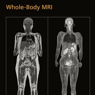 Whole body