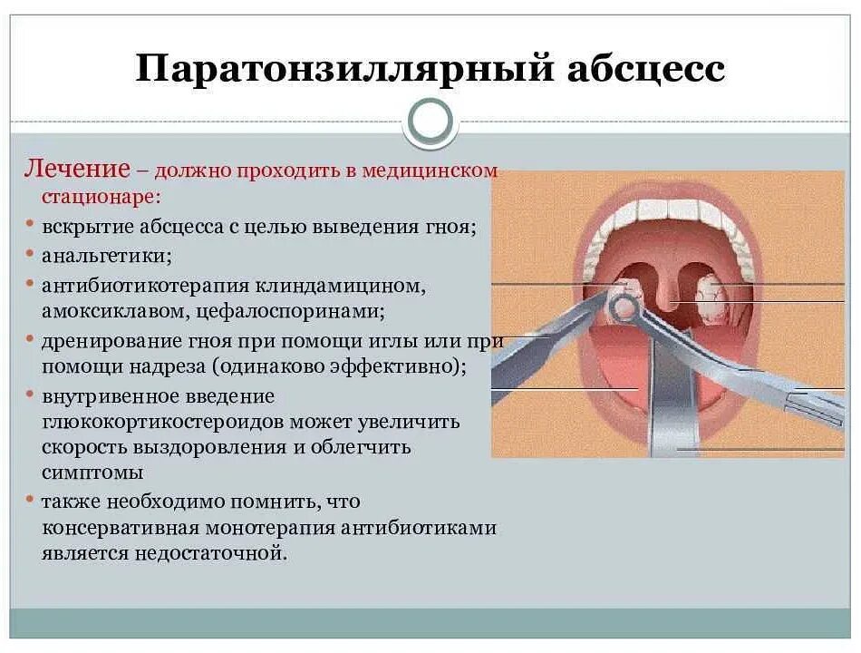 Асимметрия зева