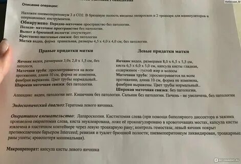 Удаление яичников у женщин после 50 лет