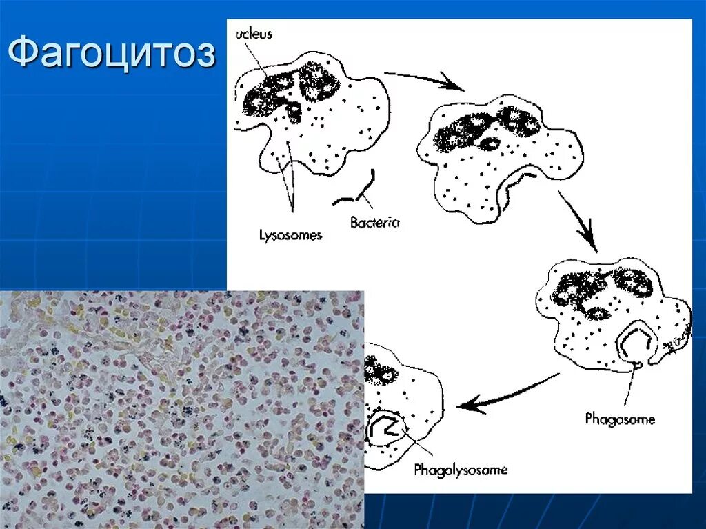 Фагоцитоз прокариот. Схема незавершенного фагоцитоза. Фагоцитоз рисунок. Незавершенный фагоцитоз гонококков. Схема фагоцитоза.