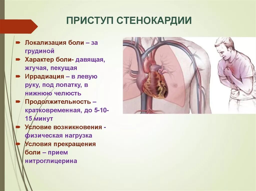 Боль давит. Приступ стенокардии. Болевой приступ при стенокардии. Механизм возникновения приступа стенокардии. Стенокардия механизм возникновения болей.