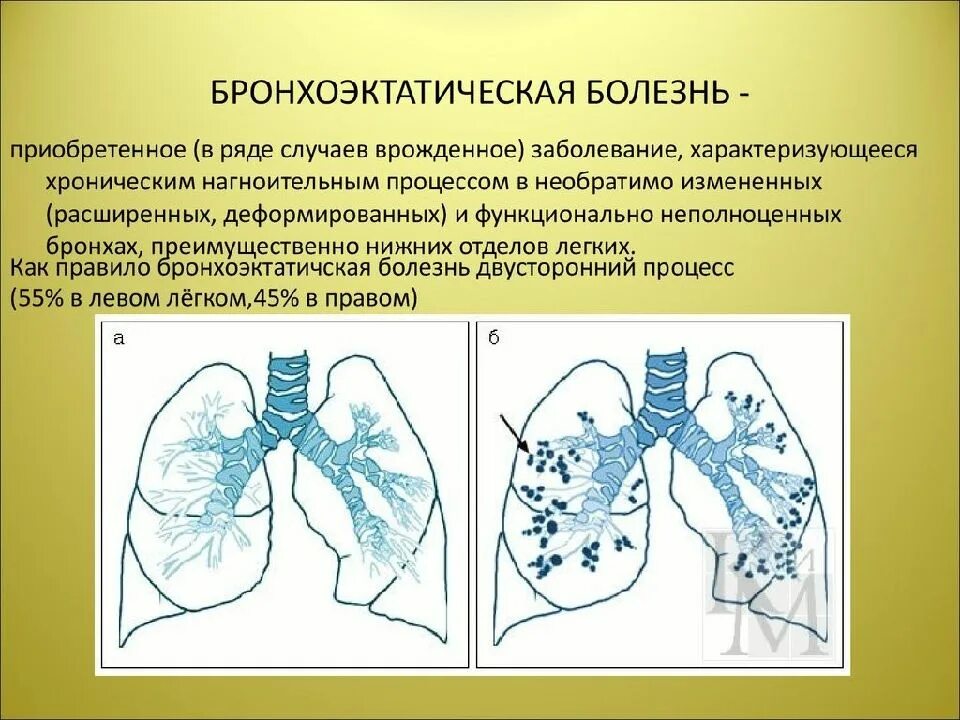 Какие изменения в легких