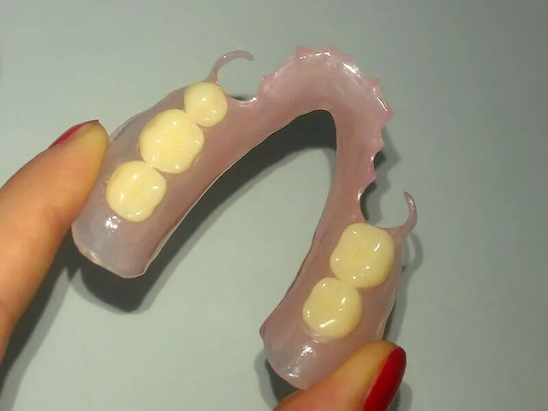 Несъемные протезы на имплантатах. Протезирование калининград. Лаборатория зубных протезов. Акри фри зубные протезы. Протезирование калининград.