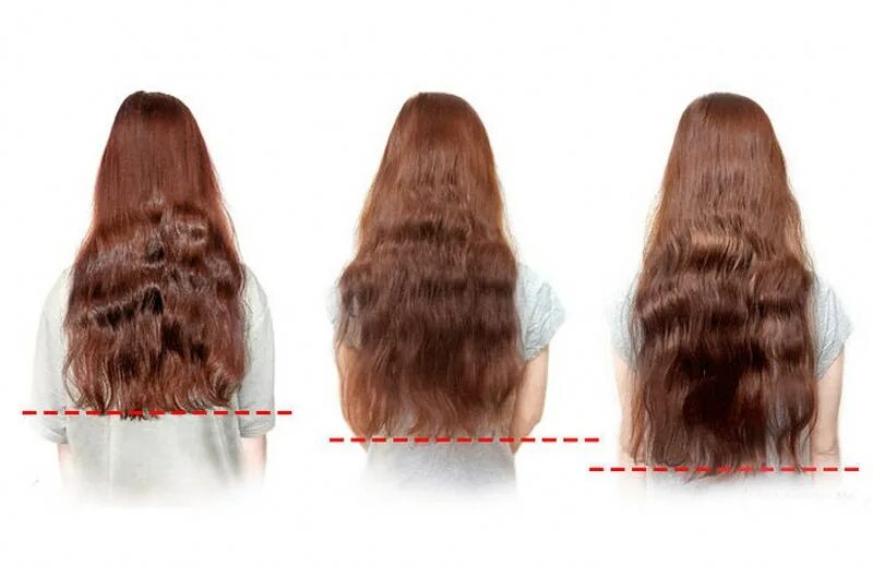 Отрастить длинные волосы. Волосы не растут в длину. Волосы не растут в длину. Женское облысение до после. Волосы не растут в длину.