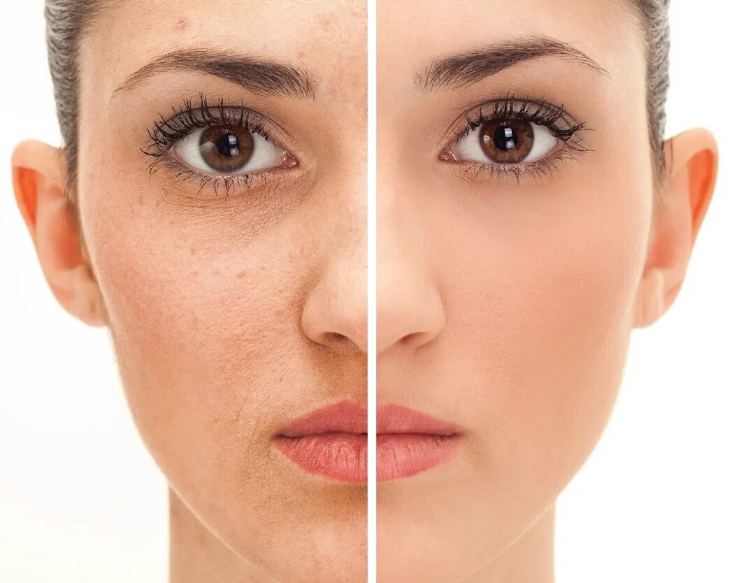 выравнивание глаз