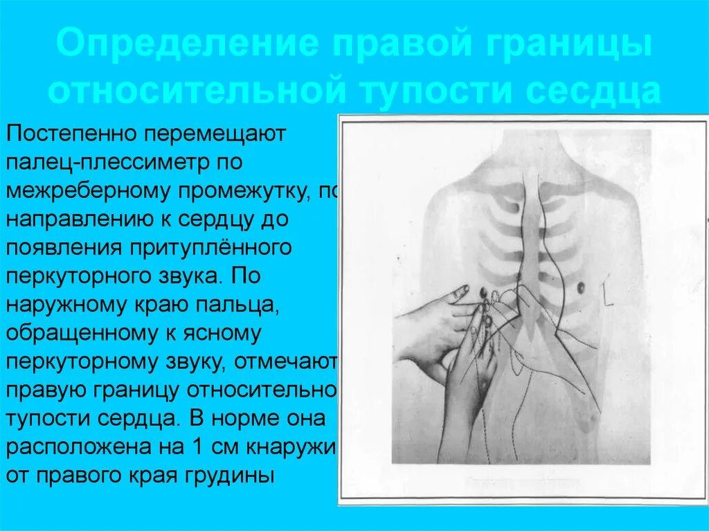 Блоки которые постепенно перемещаются по верхнему слою